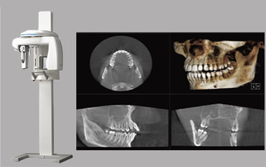 歯科用CT